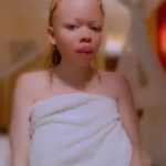 Albino Girlfriend Teasing